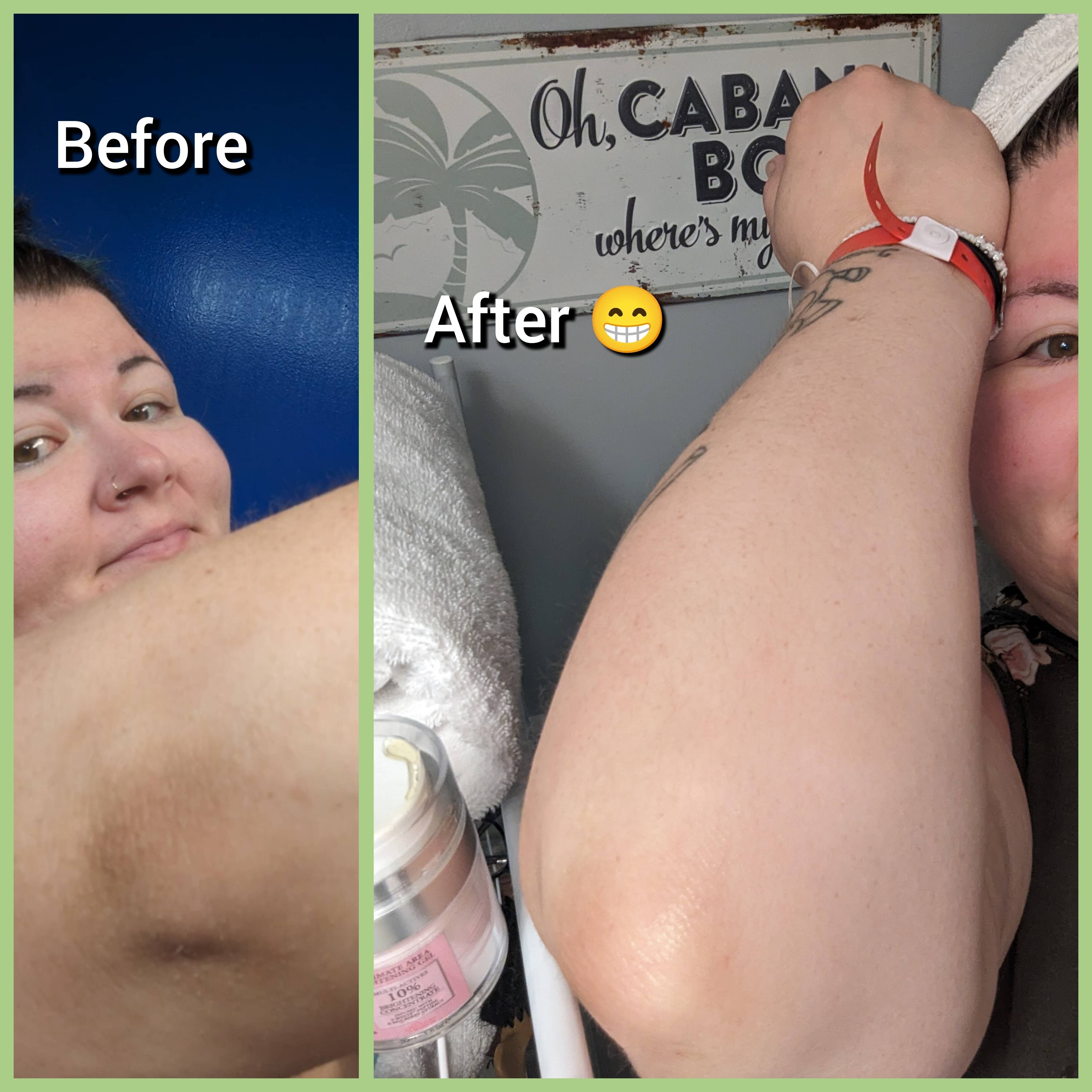 Divine Derriere – Großhandel Intimreiniger/-wischtuch – Divine Derriere Intimpflege zur Hautaufhellung für Körper- und Bikinizone6