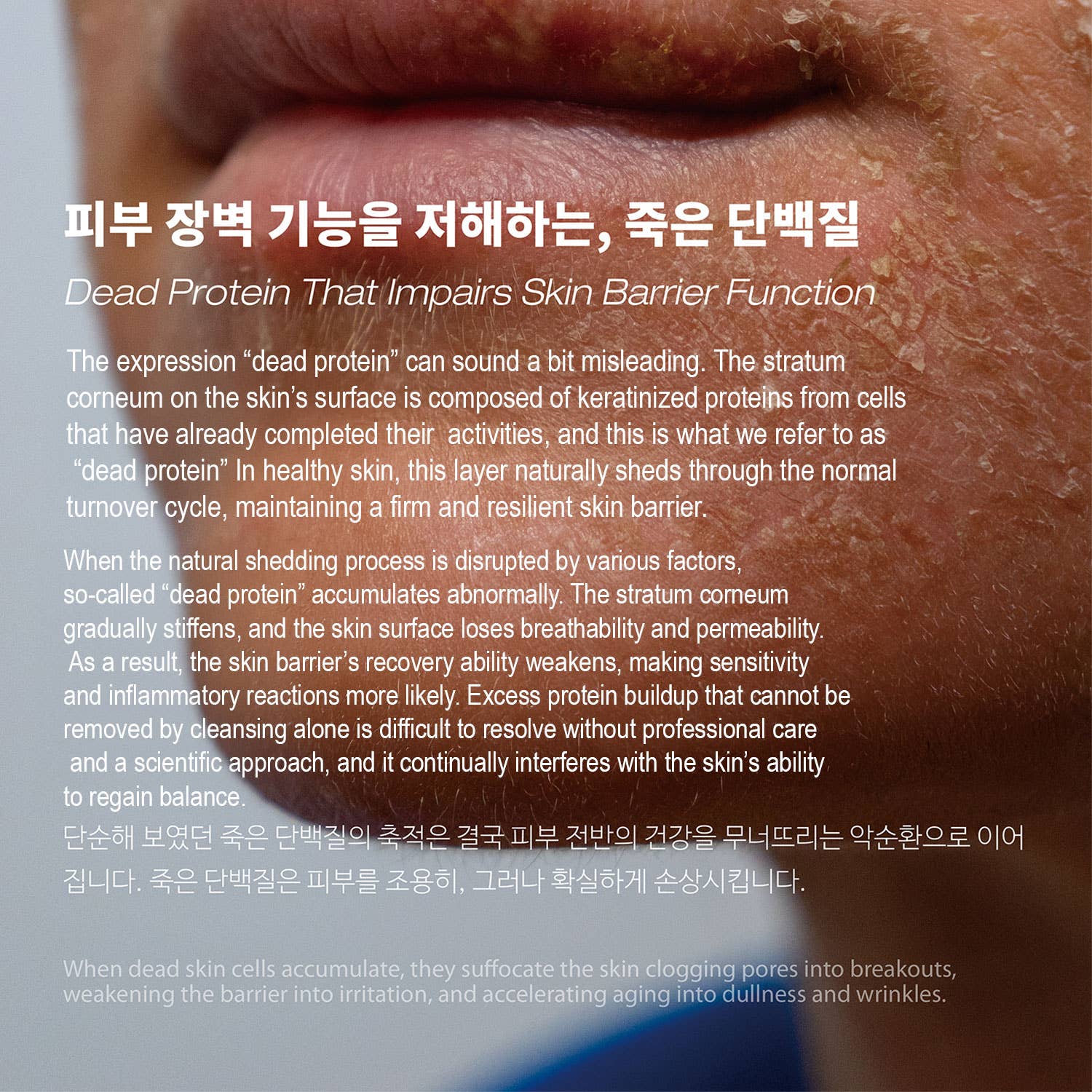 Rebeau – wholesale Facial exfoliant/scrub – Silisca UNLTRA-MICRO POWDER, ENZME EXFOLIANT 75g5