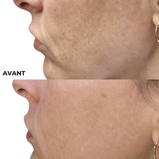 DERMEDEN - Wholesale Night Cream - Intense Night Cream2