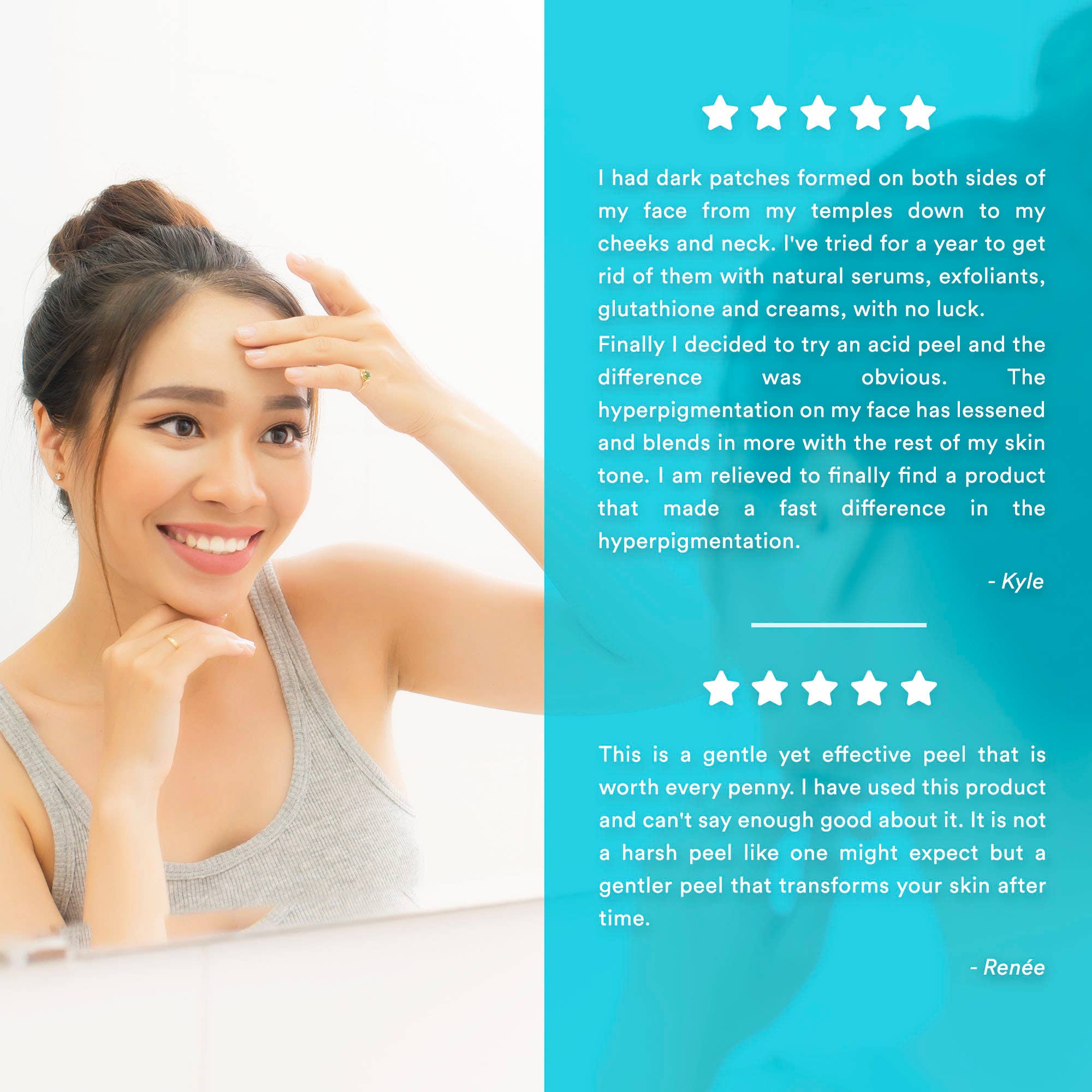 Perfect Image - Wholesale Facial Peel - Lactic 50% Gel Peel - Level 28