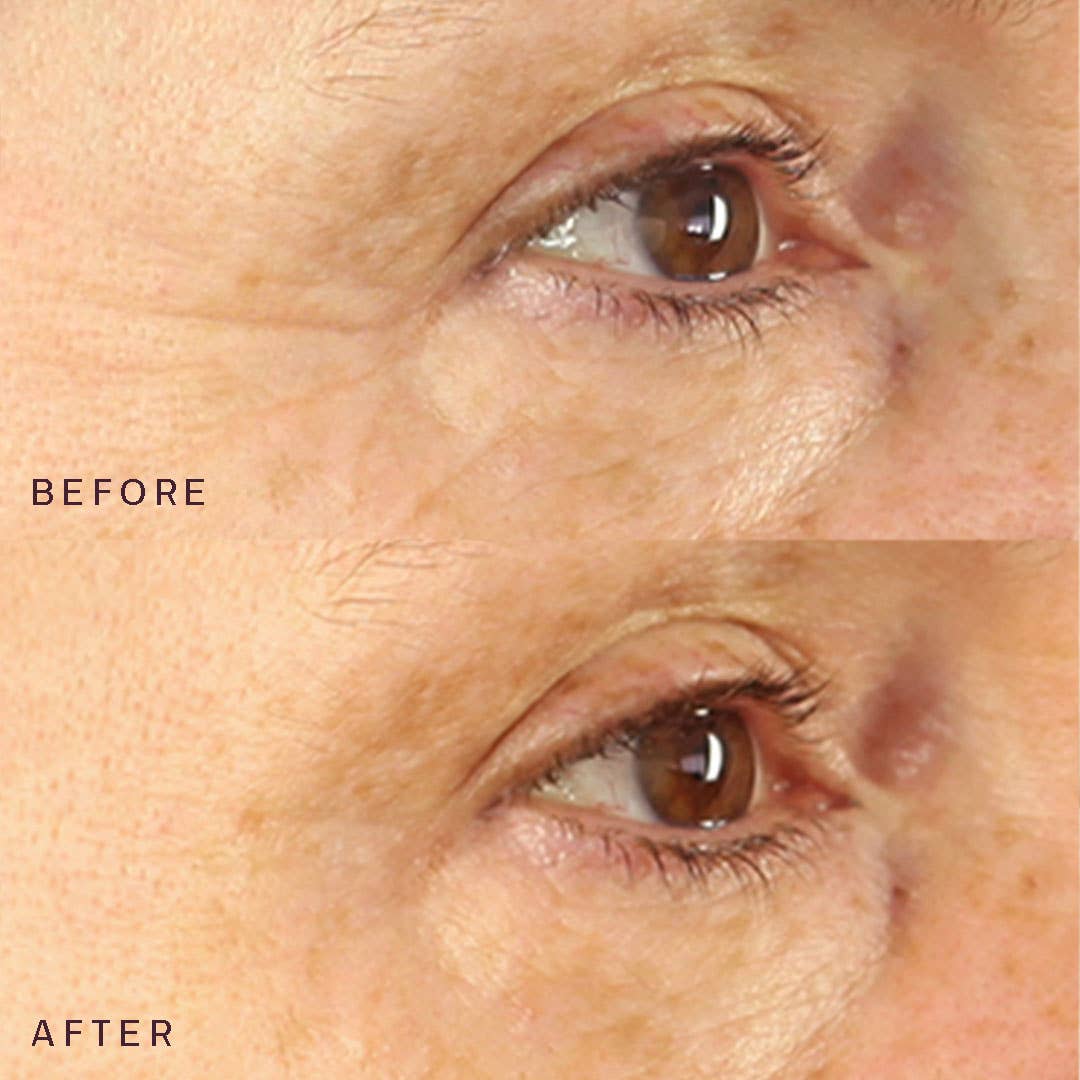 Dermaclara Beauty – wholesale Ansiktsmasker – BACKBAR: Förpackning med 10 ögon- och munocklusionsplåster™7