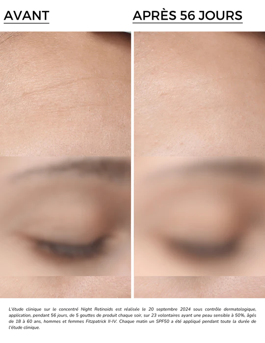 DERMEDEN – Engroshandel Ansigtsserum – Night Retinoid Concentrate 6% - intensiv anti-age behandling3