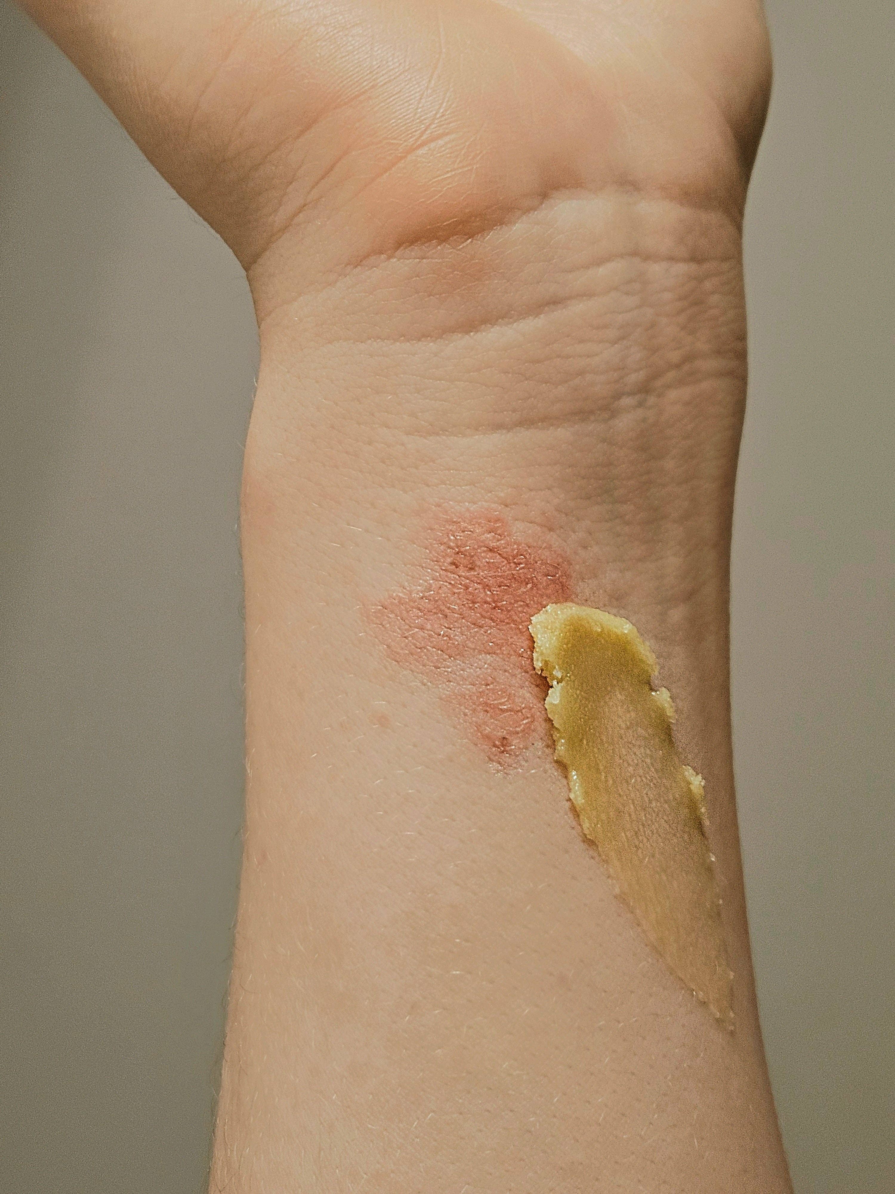 Stay Wild Apothecary - Wholesale Healing Salve/Balm/Cream - Overnight Healing Balm for Eczema, Psoriasis, and Extra Dry Skin5