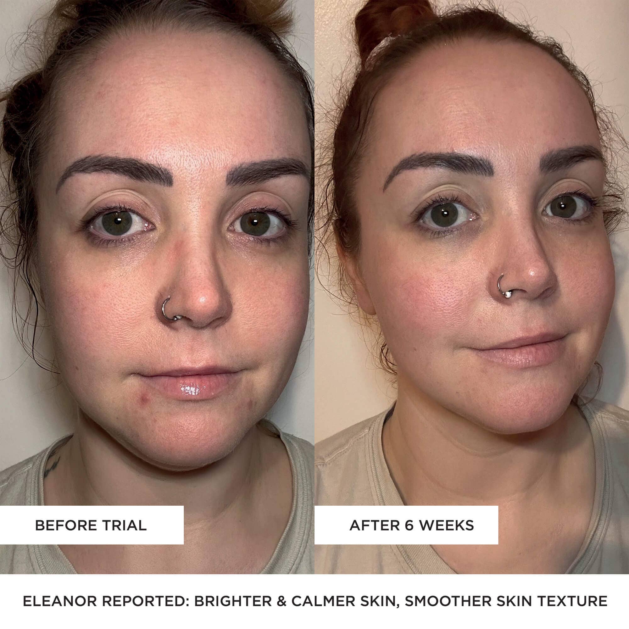 BEAUTYPRO – wholesale Electronic skincare device – LED Wand - 5 in 1 Anti-Ageing Device5