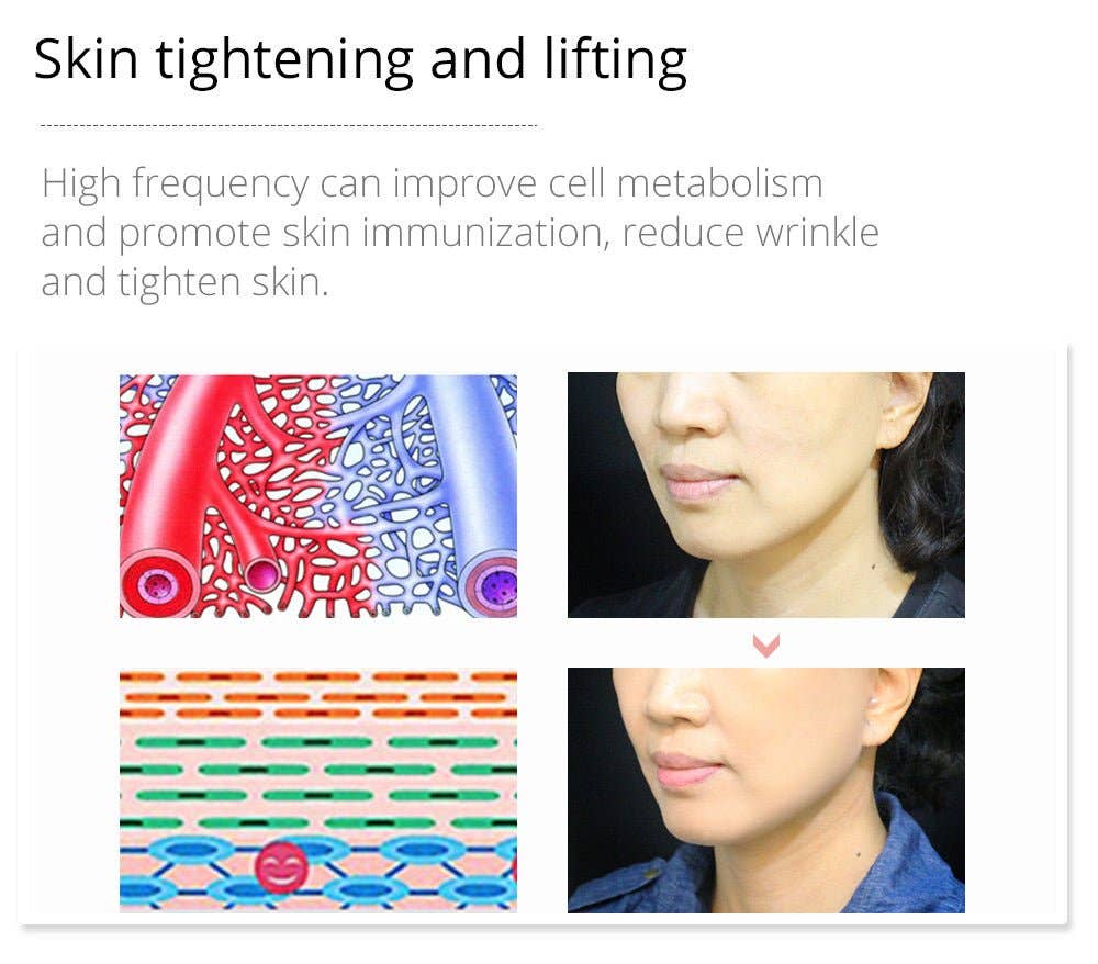 Cavitation Machines - Wholesale Electronic Skincare Device - Shape Tactics Violet 7-Electrode High-Frequency Facial System18