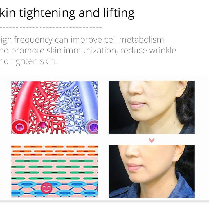 Cavitation Machines - Wholesale Electronic Skincare Device - Shape Tactics Violet 7-Electrode High-Frequency Facial System18