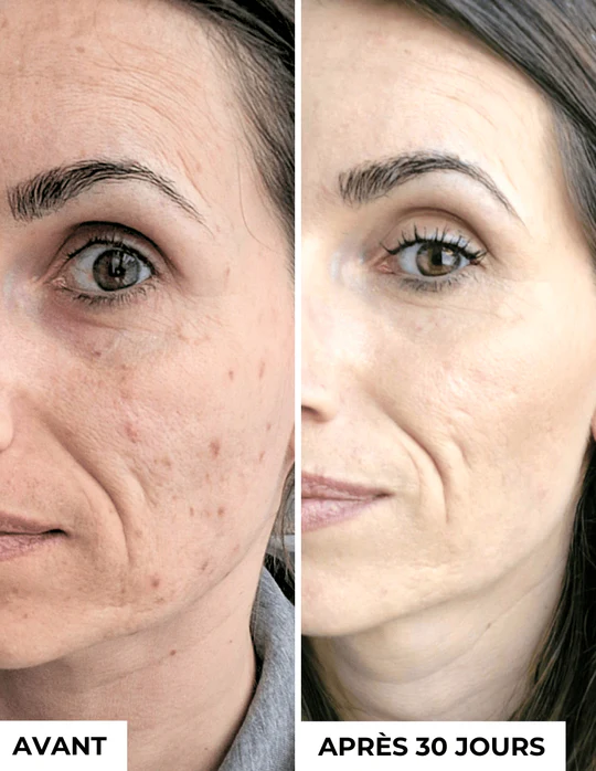 DERMEDEN - Venta al por mayor Sérum facial - Concentrado anti-manchas oscuras2