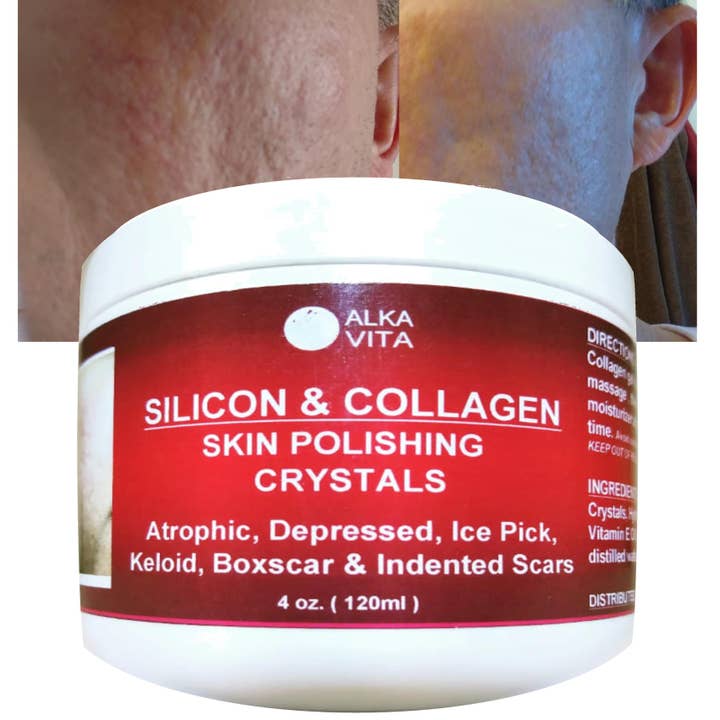 AlkaVita - Wholesale Hydrocolloïde acnepleister - Acne Huidlittekens SILICON Polishing Crystals Gel Ingesprongen huid