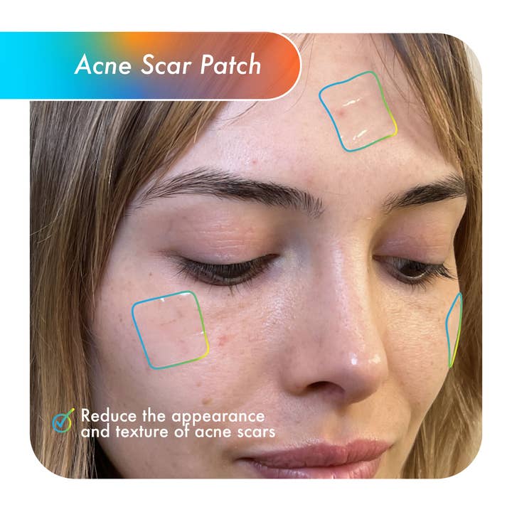 Fazit – wholesale Akne-/hydrokolloidplåster – Fazit Acne Scar Patches för ansikte, bikini och kropp