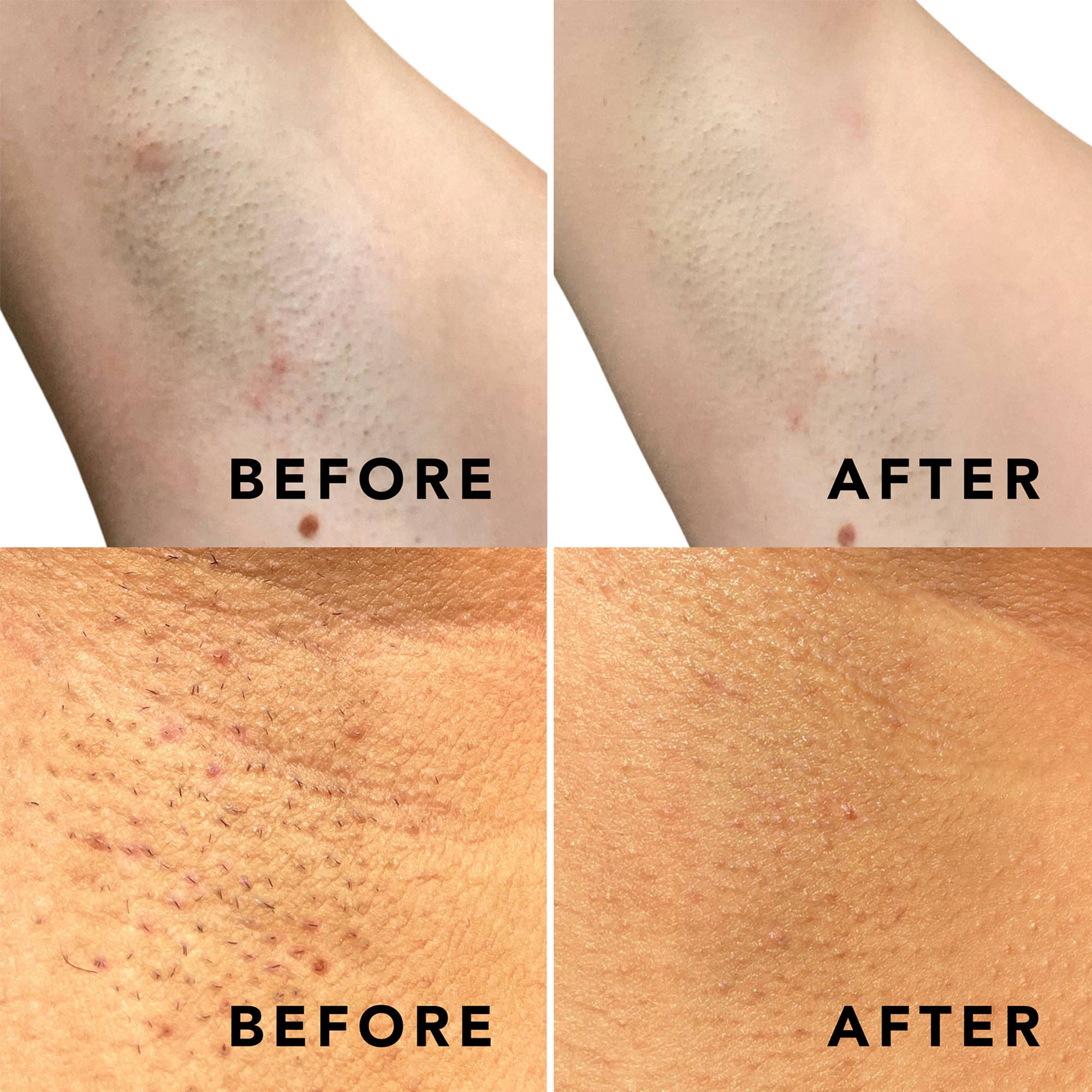 Sweetspot Labs - Wholesale Hair Spray - Buff & Brighten Ingrown Hair Treatment Spray4