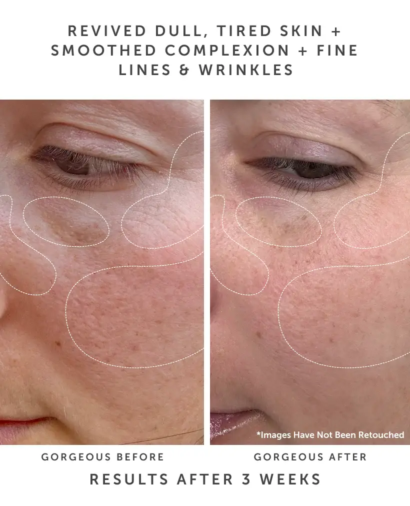 Earth Harbor Naturals - Wholesale Facial Serum/Concentrate - ANCHOR Bio-Retinol Youth Serum: Youthful Treatment3