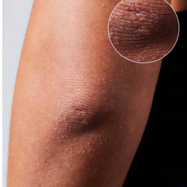 Lanolips - Wholesale Body Cream/Lotion - 101 Dry Skin Super Cream - Multipurpose For Face + Body10