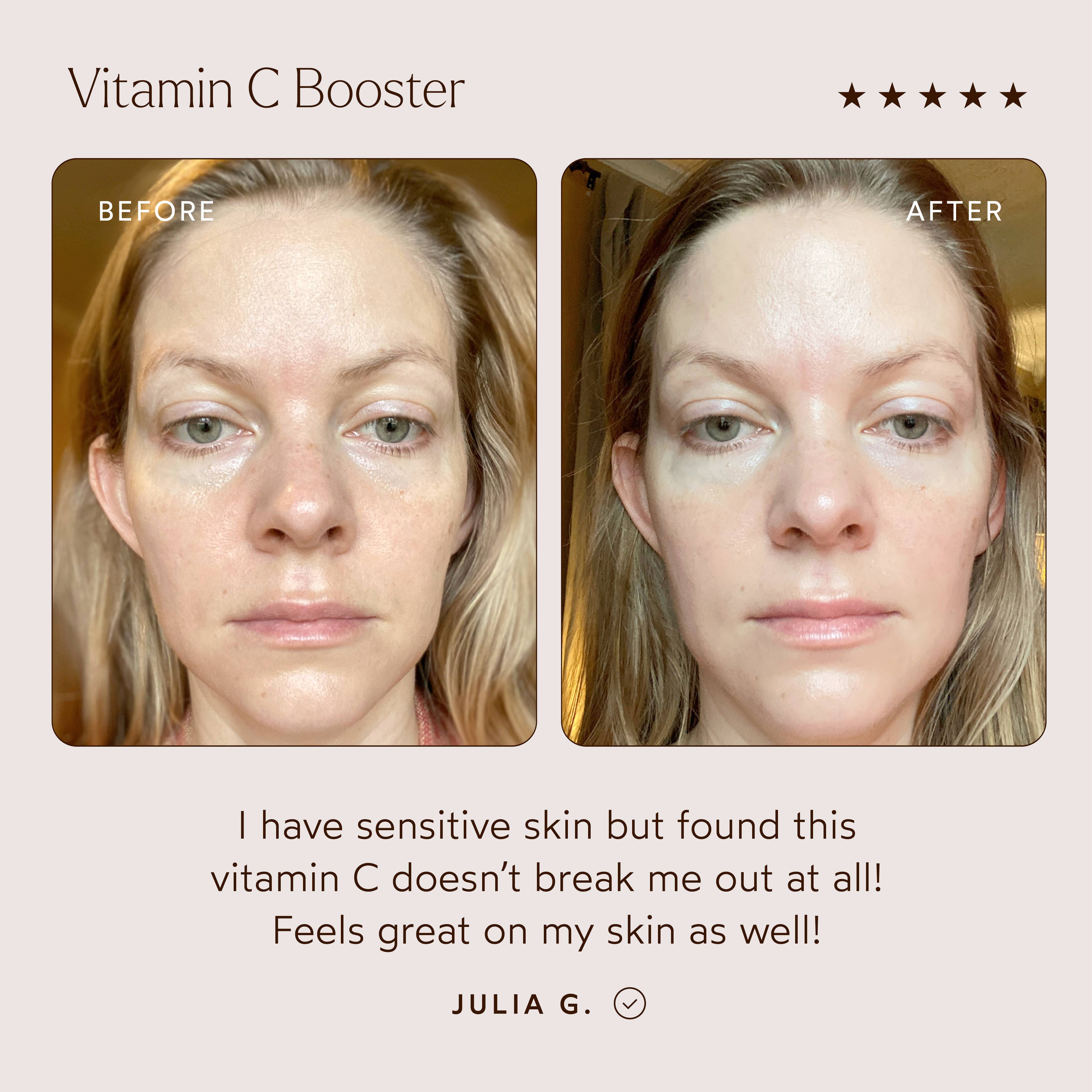 True Botanicals - Wholesale Facial Serum/Concentrate - Vitamin C Booster2