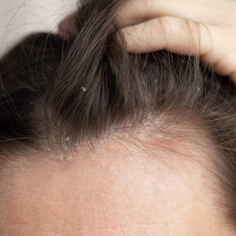 NaturAloe – Champô por atacado – Shampoo orgânico para cuidados com Aloe Vera1