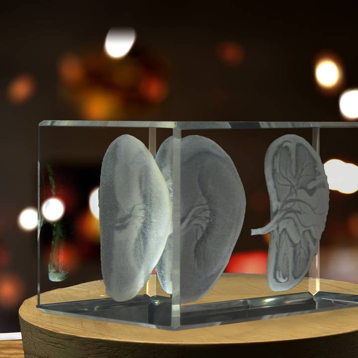 AB Crystal Collection - Wholesale Decorative Tabletop Object - Spleen | 3D Engraved Crystal Keepsake | Doctor Gift4