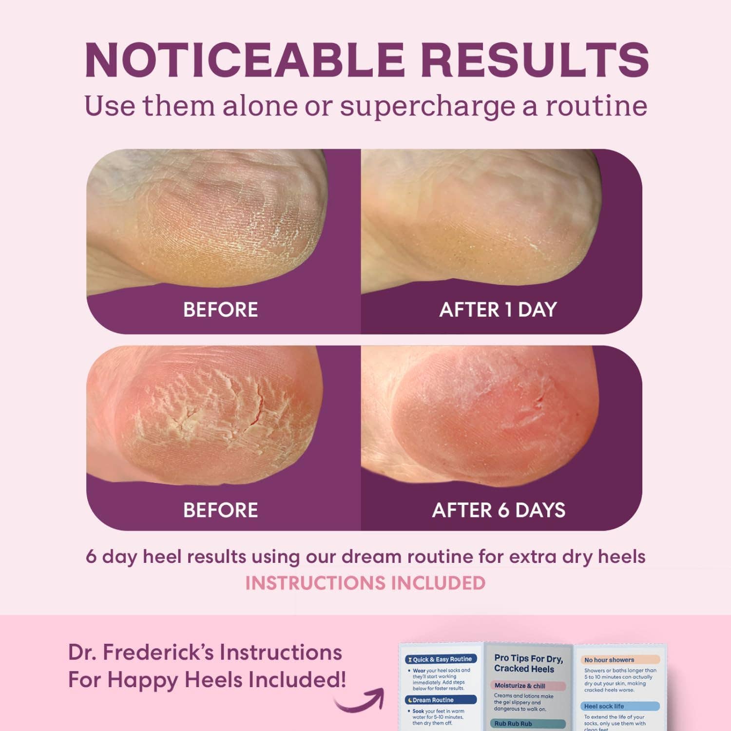 Dr. Frederick's Original - Wholesale Moisturizing Socks - Moisturizing Heel Socks - Fuzzy - 1 Pair - Relaxing Rose8