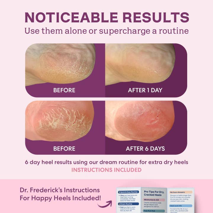 Dr. Frederick's Original - Wholesale Moisturizing Socks - Moisturizing Heel Socks - Fuzzy - 1 Pair - Relaxing Rose8