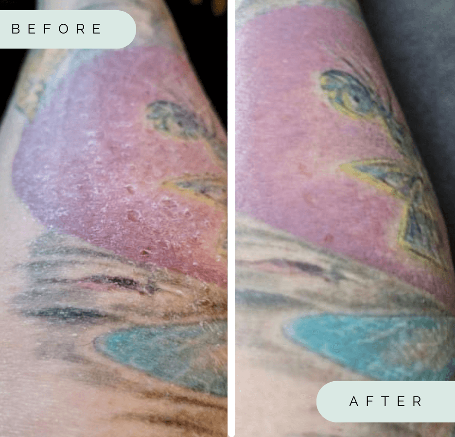 Wildpier Beauty - Vendita all'ingrosso Guanti/muffole esfolianti - Guanto esfoliante profondo Wildpier ™️ Plus+2