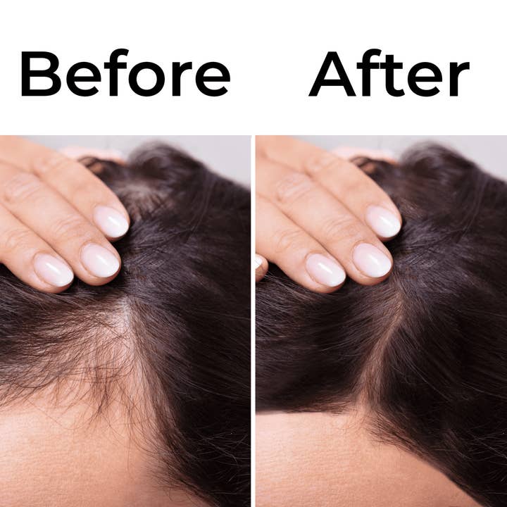 blackpantherstrong - Wholesale Hair oil - Batana Oil Drops Raw and Pure Hair Solution.4