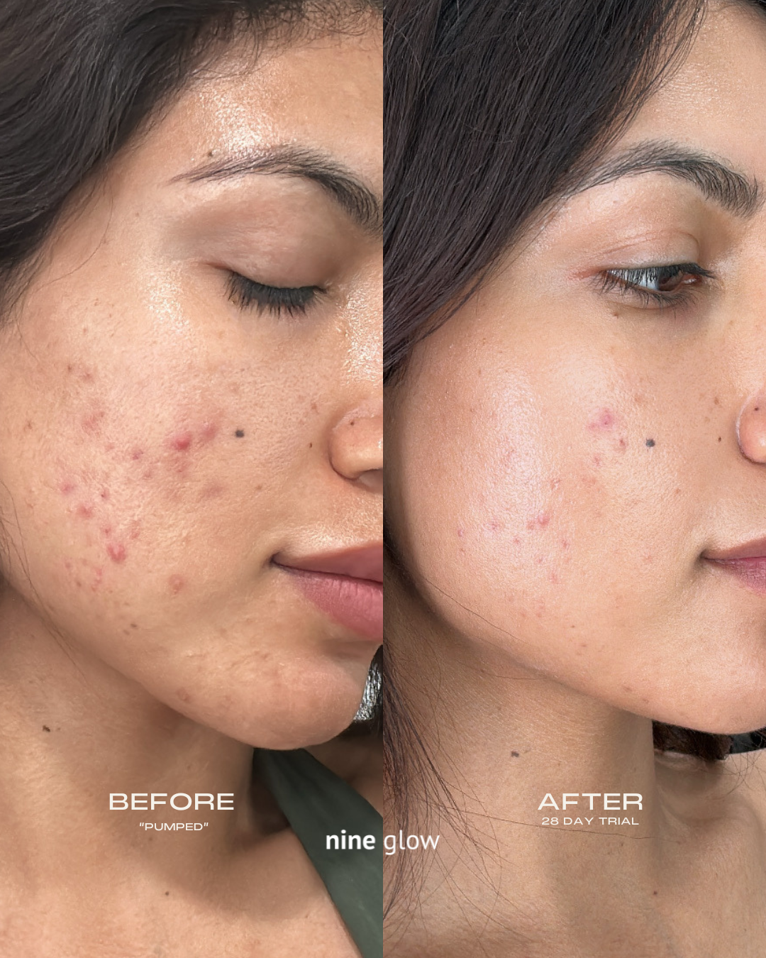 nine glow - Wholesale Facial Toner - PUMPED Micellar Toning Essence5