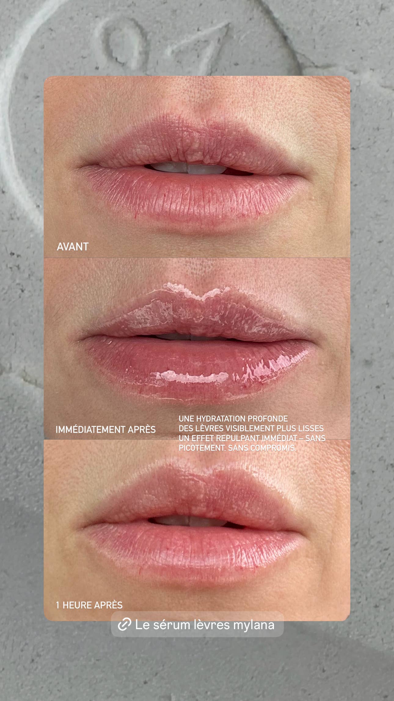 MYLANA - Vente Soin/masque pour les lèvres - LE SÉRUM LÈVRES MYLANA6