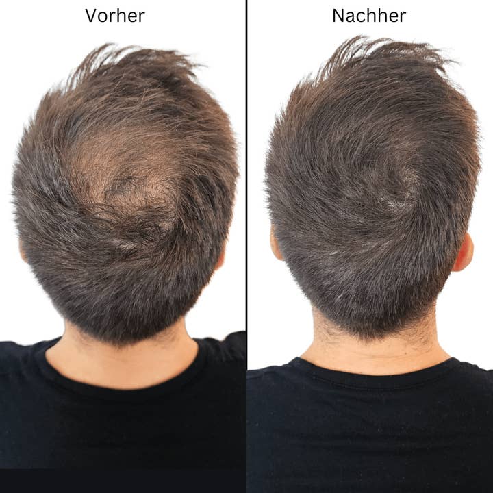 Fidentia Store – Großhandel Behandlung für dünnes Haar/Haarausfal – Fidentia Haarauffüller Spray 200 ml