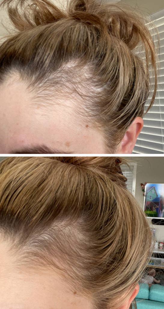 Candy Cush - Wholesale Face/Beauty Roller - dermaroller 0.5 mm6