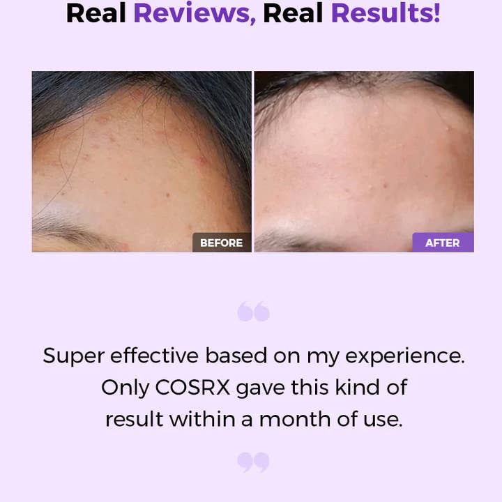 Best Beauty Group - Wholesale Facial Toner - COSRX AHA BHA Clarifying Treatment Toner K-Beauty2