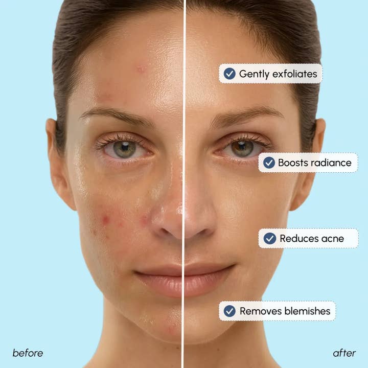 VIAI Beauty - Wholesale Facial Toner - Glow Boost Glycolic Face Toner3