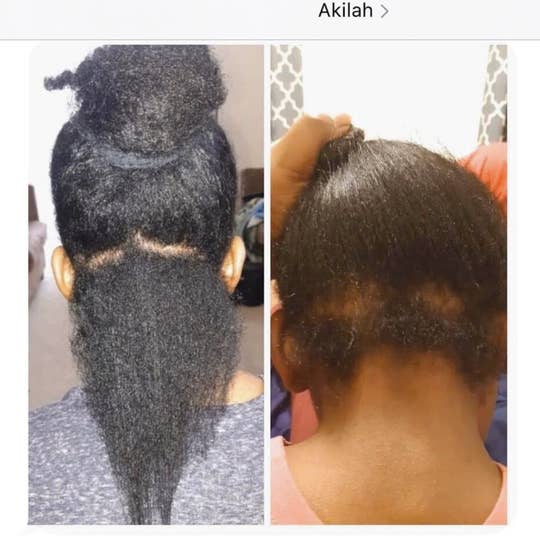 Naturalicious - Vendita all'ingrosso Oli per capelli - Olio di Ricrescita di Mandorle Spagnole2