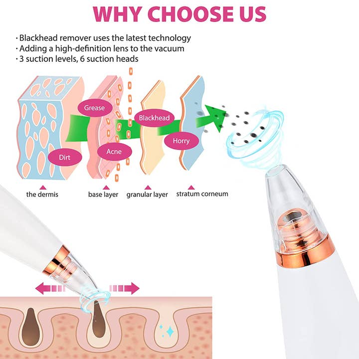 Savoy Active - Wholesale Electronic Skincare Device - Vacuum Blackhead Remover