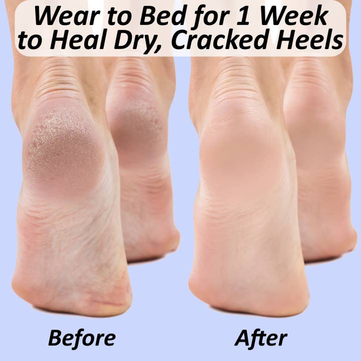 The Foot Medic - Wholesale Moisturizing Socks - 1 Pair Moisturizing Heel Socks for Cracked Heel Treatment