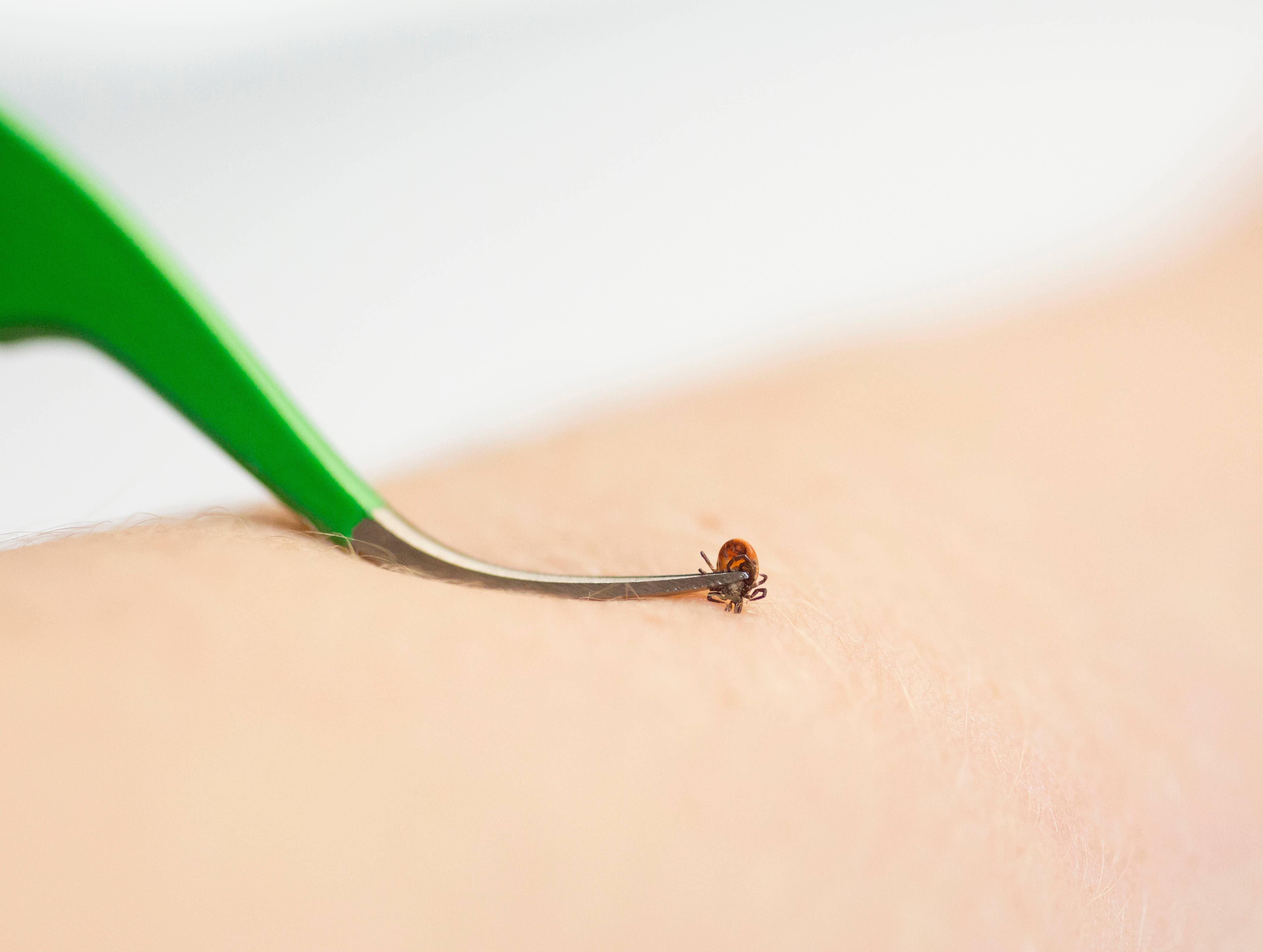 TickCheck – wholesale Insect repellent – TickCheck Premium Tick Remover Kit3