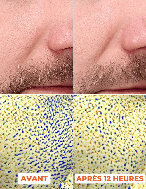 DERMEDEN - Vente Masque exfoliant pour le visage - Peeling avancé en 2 étapes inspiré de techniques dermatologiques5