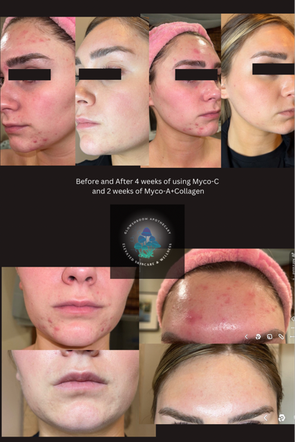 Glowshroom Apothecary - Wholesale Facial Serum/Concentrate - Myco-A + Collagen – Mushroom, 1% Retinol & Collagen Serum3