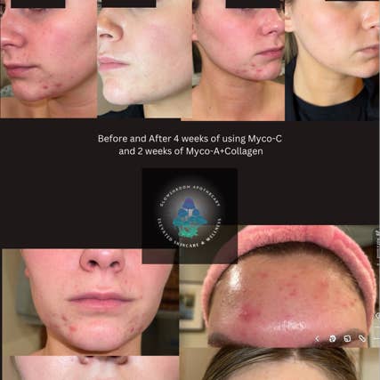 Glowshroom Apothecary - Wholesale Facial Serum/Concentrate - Myco-A + Collagen – Mushroom, 1% Retinol & Collagen Serum3