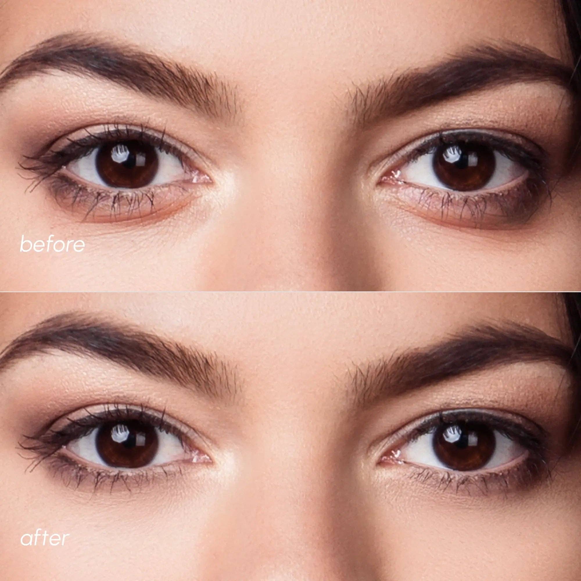 VIAI Beauty - Wholesale Eye Treatment Mask - MAREE Violet Eye Patches for Dark Circles3