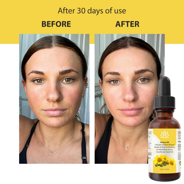 Relaxcation - Wholesale Bath/body oil - Pure Arnica Organic Oil1