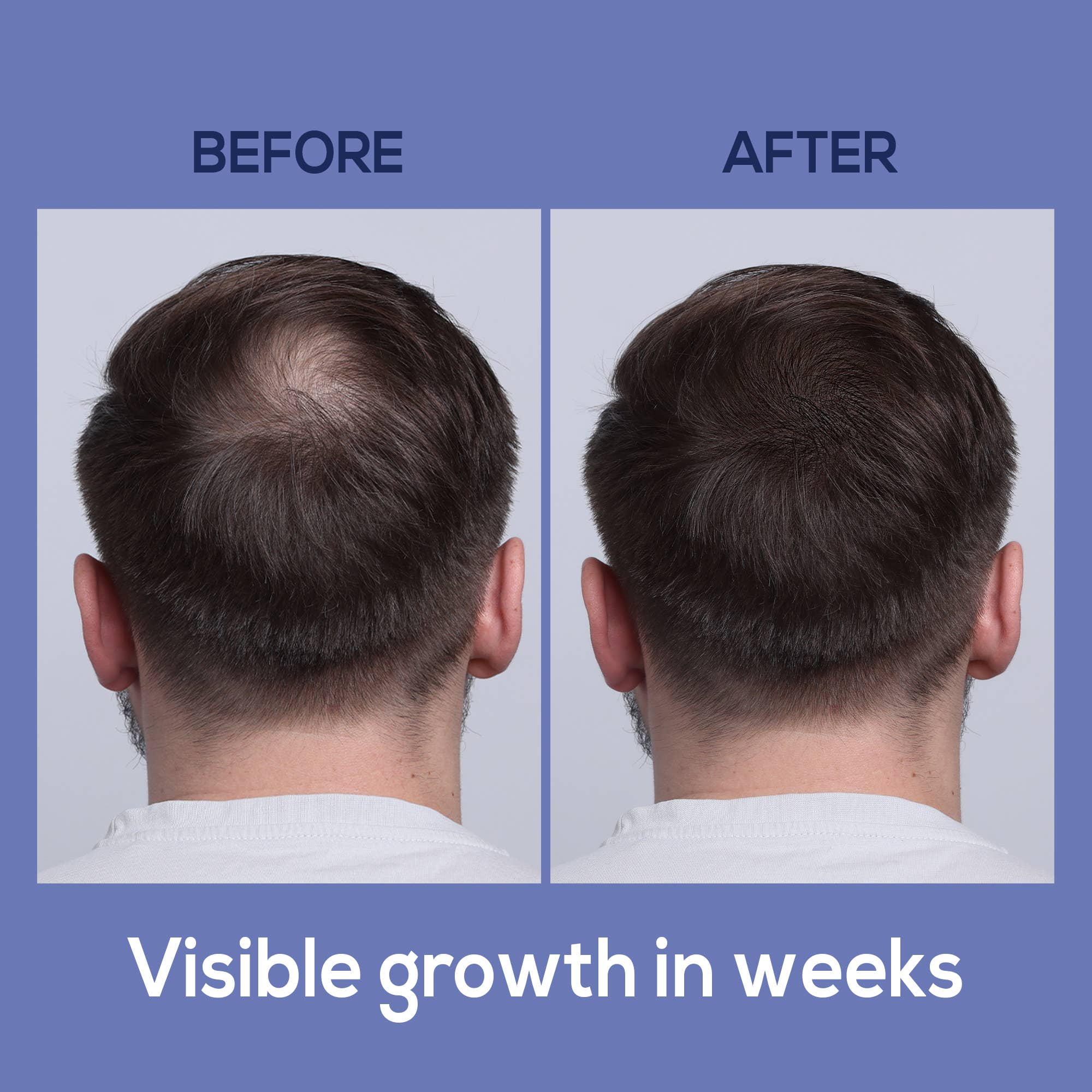 HARMONIFY - Vendita all'ingrosso Lacca per capelli - Spray d'Acqua di Riso Nero HARMONIFY per la Cura dei Capelli4