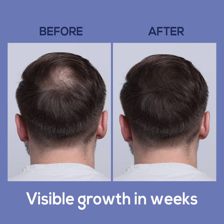 HARMONIFY – Großhandel Haarspray – HARMONIFY Schwarzer Reiswasser-Spray zur Haarpflege4