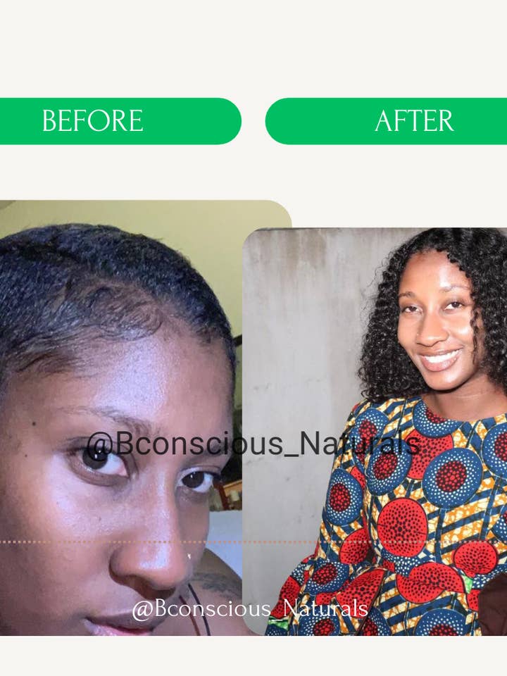 Pcos Queen Hair Loss Natural Hair Growth Oil for wholesale by bconsciousnaturals