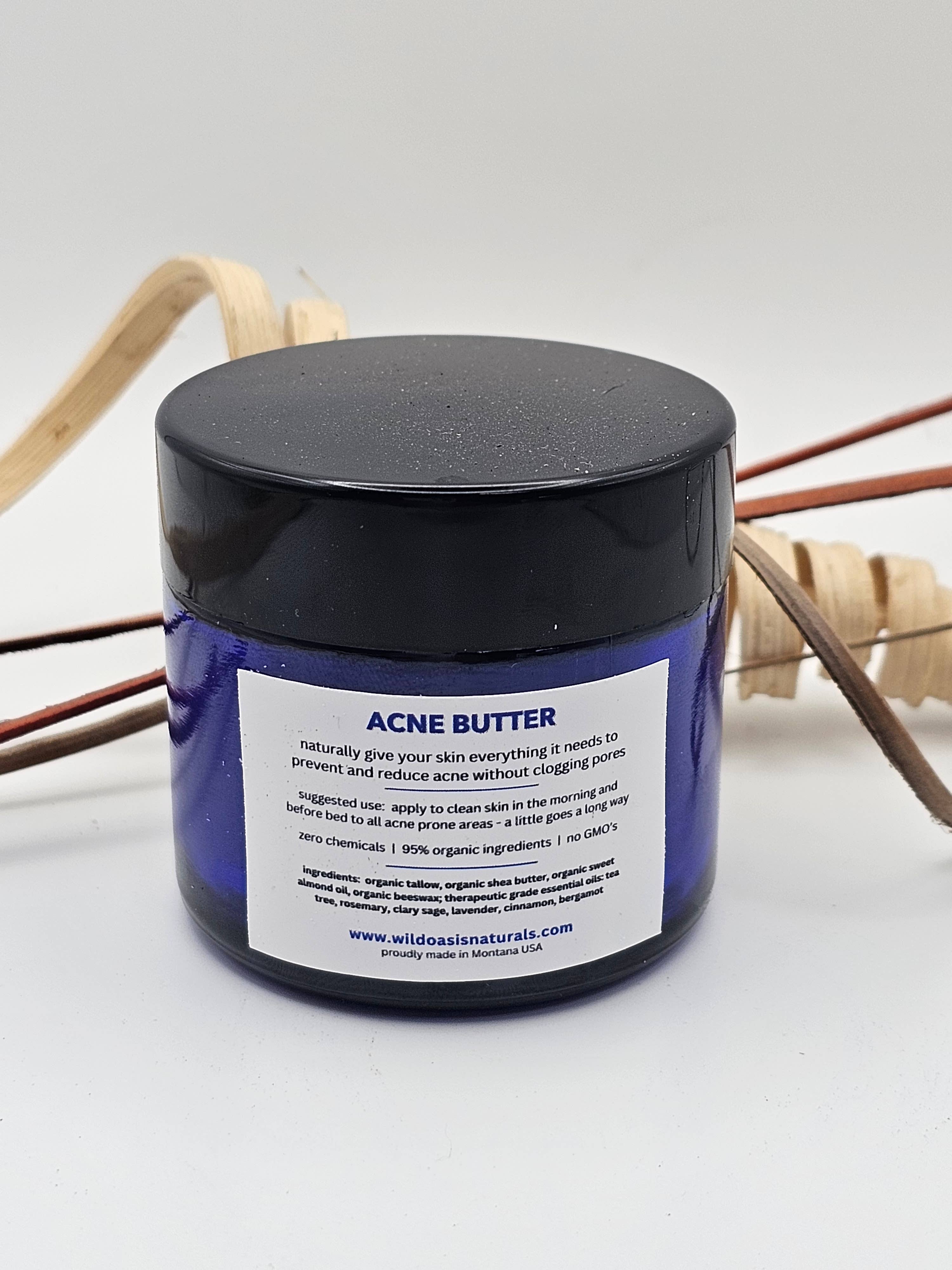 Wild Oasis Naturals - Wholesale Acne/Hydrocolloid Patch - Acne Butter - 2 oz - Organic Tallow Anti-Acne Cream3