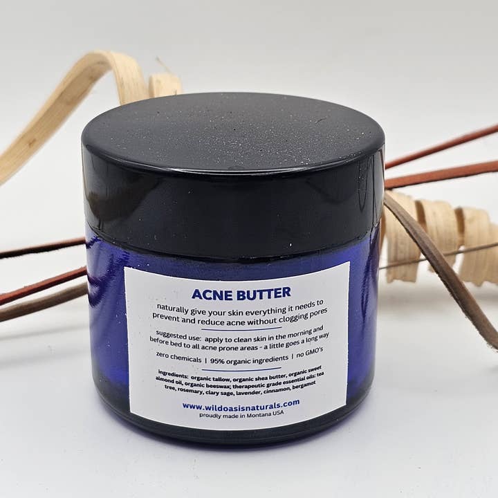 Wild Oasis Naturals - Wholesale Acne/Hydrocolloid Patch - Acne Butter - 2 oz - Organic Tallow Anti-Acne Cream3