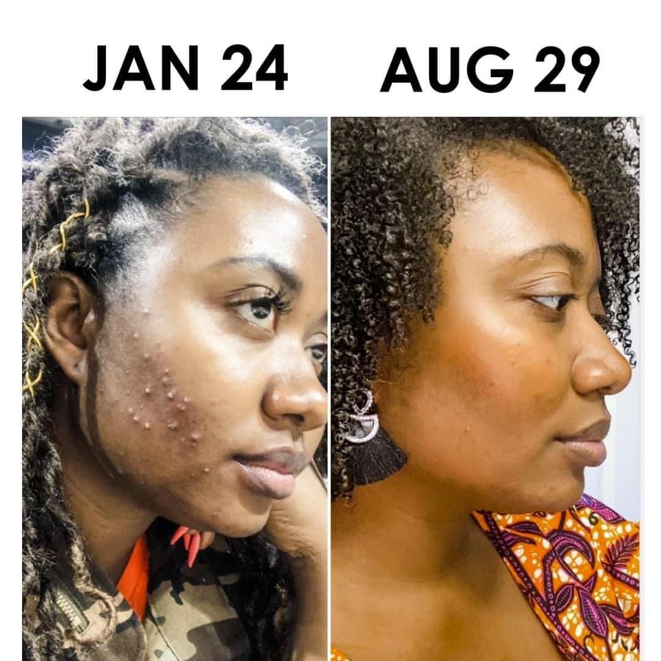 Naturalicious - Wholesale Skincare Face Mask - Flawless Canvas Face Masque1