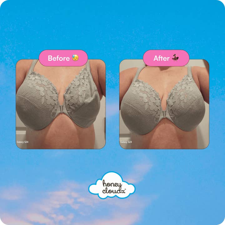 Honey Cloudz - Wholesale Bra Inserts - Women's - Teardrop Breast Form – Post-Mastectomy14