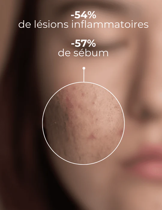 DERMEDEN - Vente Nettoyants pour le visage - Gel nettoyant purifiant3