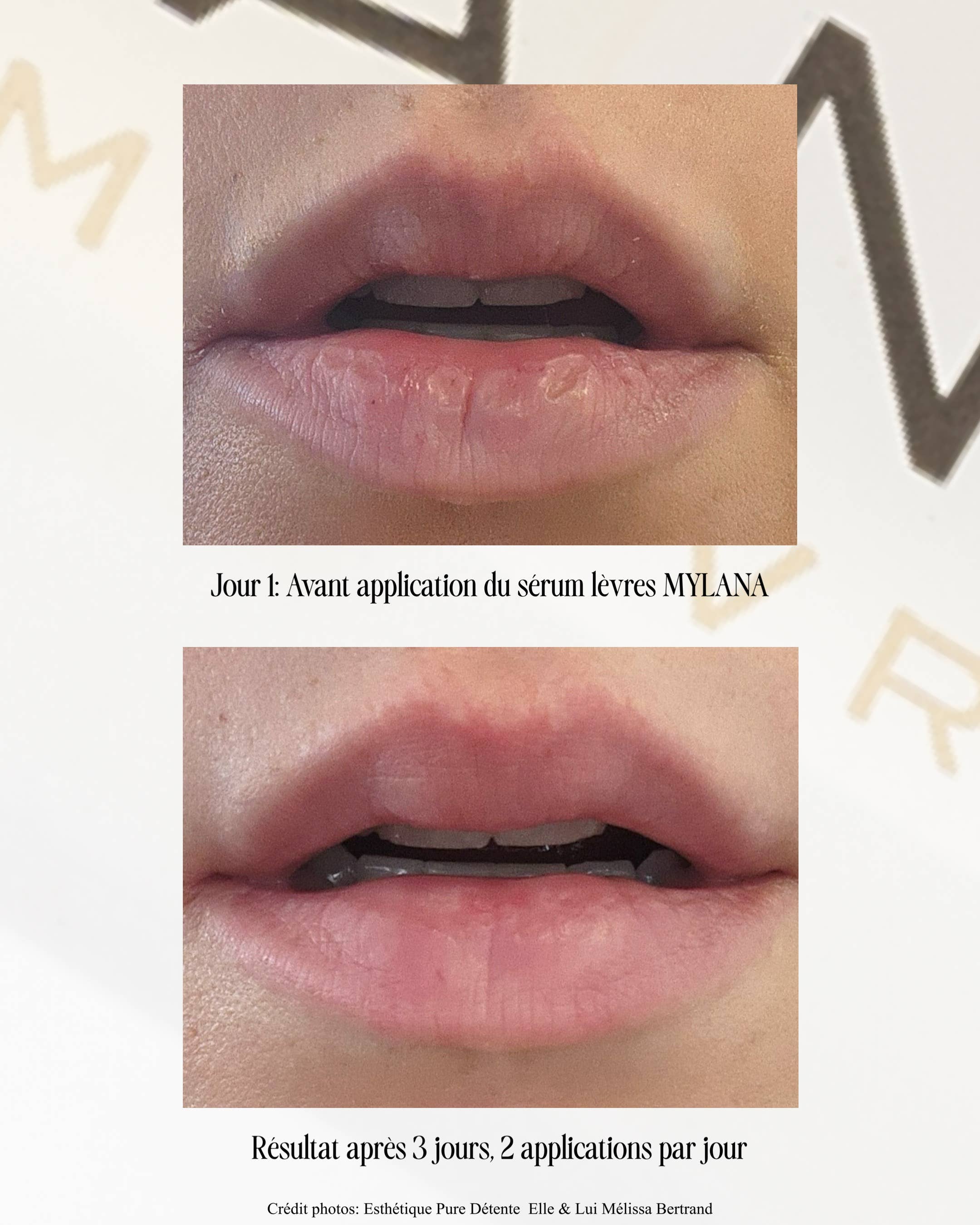 MYLANA - Vente Soin/masque pour les lèvres - LE SÉRUM LÈVRES MYLANA7