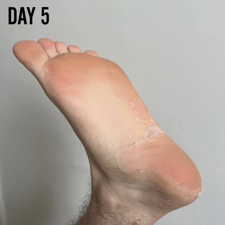 BARBER PRO - Wholesale Foot Mask - BARBER PRO Foot Peel - Prep the feet for Summer!