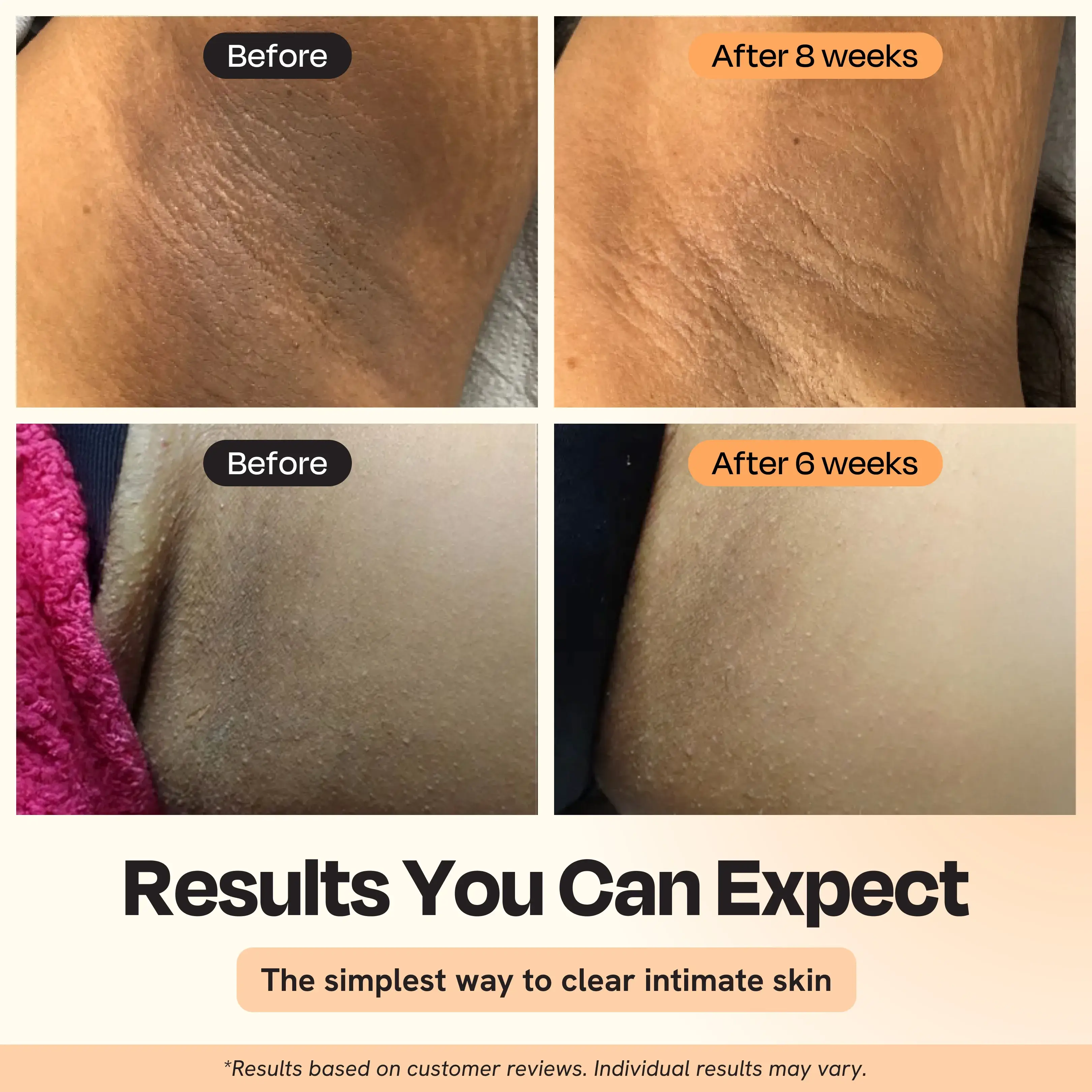 Gleamin - Wholesale Intimate Cleanser/Wipe - Illuminating Intimate Serum
5