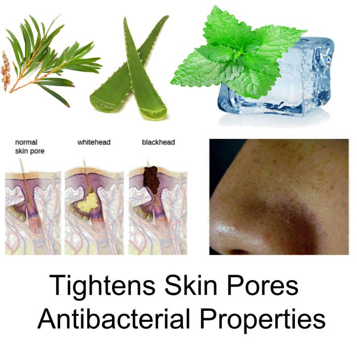 AlkaVita - Wholesale Acne/Hydrocolloid Patch - Skin Pore Closer Silica & Aloe Vera IceSkin Gel Cold Effect1